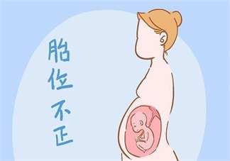 分娩是選順產還是剖腹產 醫生往往會參考這些數據