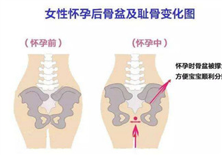 恥骨痛怎么辦 孕晚期如何緩解恥骨痛