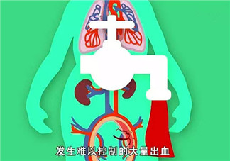 哪些人更容易產后出血 產后出血發病癥狀(如何預防產后大出血)