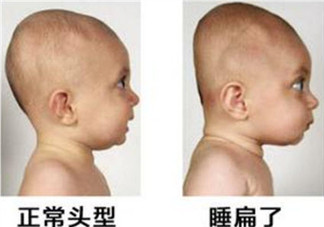 寶寶頭型睡偏了怎么辦 寶寶頭型調整怎么做