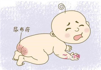 嬰兒長(zhǎng)尿布疹怎么辦 尿布疹是怎么引起的
